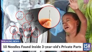 10 Needles Found Inside 3-year-old's Private Parts
