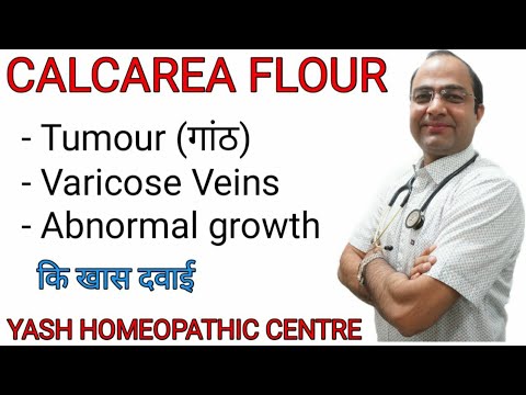 Calcarea Flour explained | Dose and symptoms | Brain tumour | varicose veins