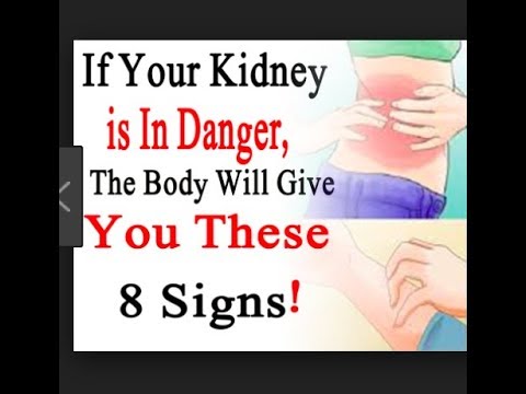 Warning Signs na Sira ang Kidneys o Bato - ni Doc Willie at Liza Ong #464