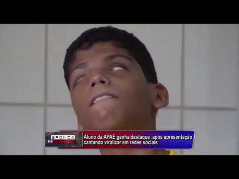 Watch lagu Images Videos Cerebral Palsy Virus, Watch Images Cerebral Palsy Virus free Watch Images, Watch Images Cerebral Palsy Virus