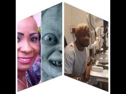 VIEUX RAPIRATA AYE LISUSU. ALOBELI OLIVE LEMBE CONCERNANT VUE DE LOIN.