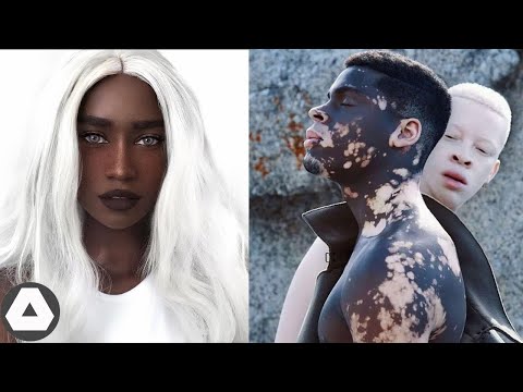 10 Unusual Black People With Rare Beauty That Shocked the World