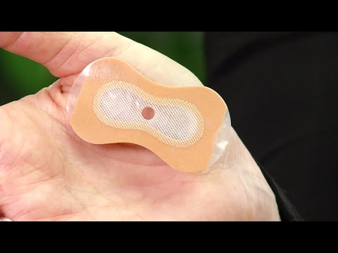 EPAP can help stop snoring