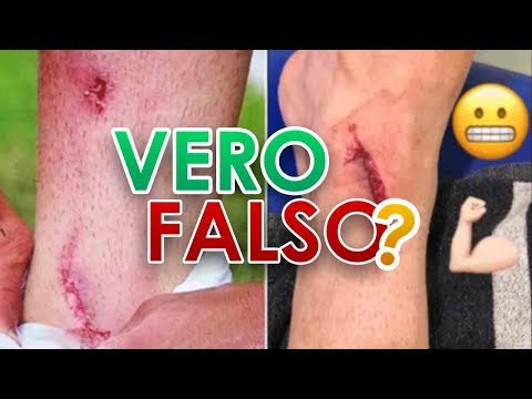 Struttura hip Forte dolore sotto la costola sul lato sinistro della schiena
