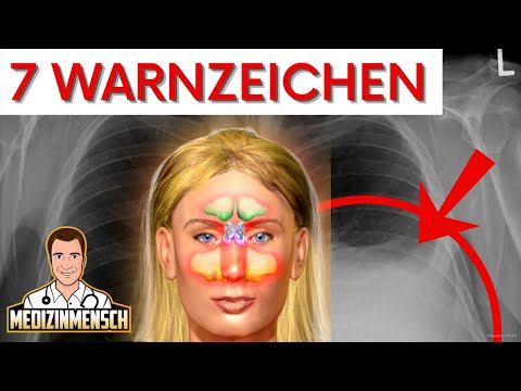 AUTOIMMUNERKRANKUNG! Immunattacken erkennen (Rheuma-Arzt erklärt Warnzeichen)