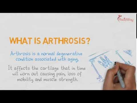 Sacrococcygealis artrosis kezelése