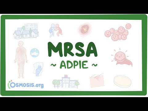 Chronic obstructive pulmonary disease Nursing Process