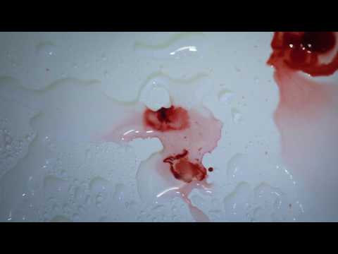 Huidpijn trailer + titelsong