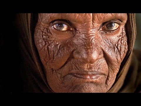 Lotseril presyo Nizhniy Novgorod Kuko halamang-singaw sa aking mga paa sa isang bata sa 6 na taon