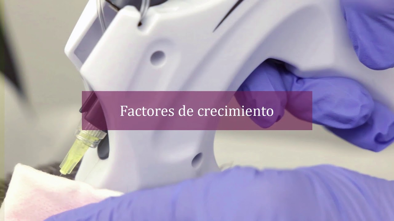 Gracia Alonso Rosales-13