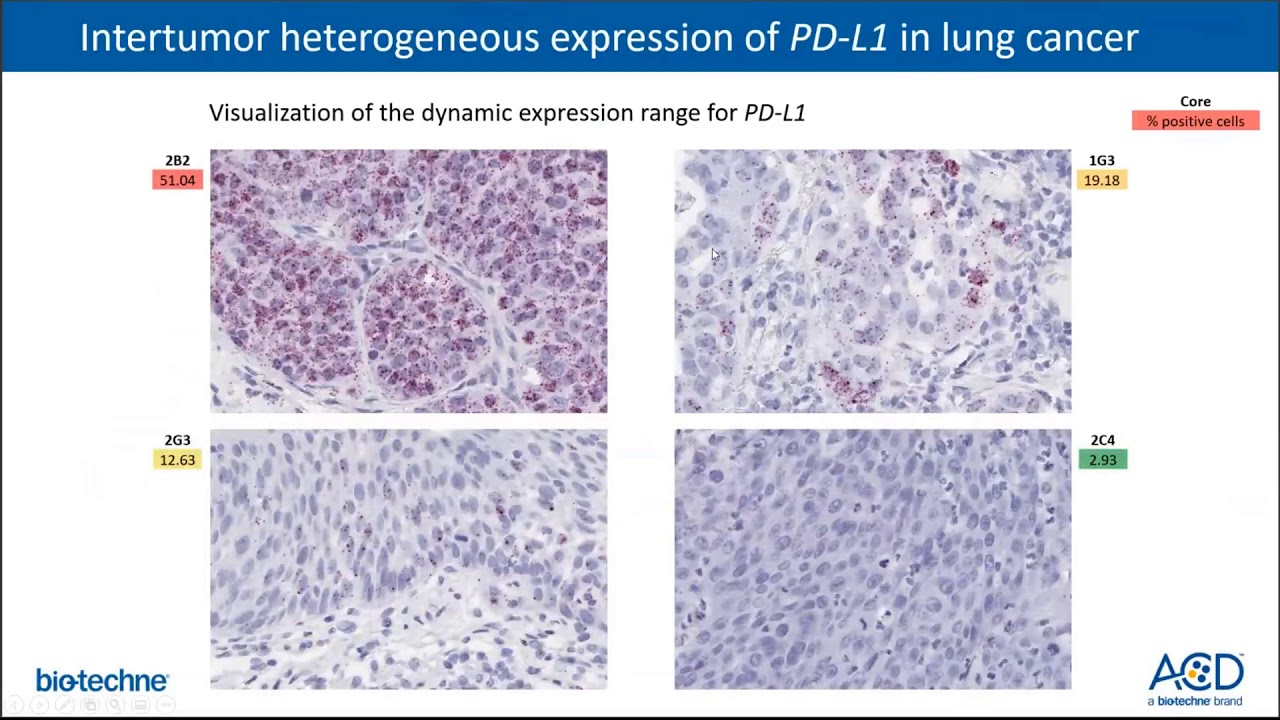 Spatial Genomics Webinar by Advanced Cell Diagnostics & NanoString Technologies_Mar2020