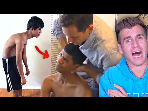 CHIROPRACTOR Changes TEEN'S LIFE After Bad Incident.. (MIRACLE!)