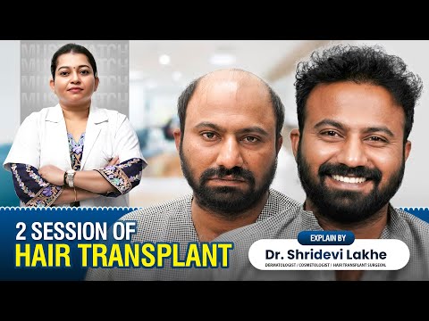 Grade 7 Case Study (4500+ Grafts)