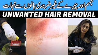 Natural Unwanted Hair Removal Remedy by Dr. Umme Raheel