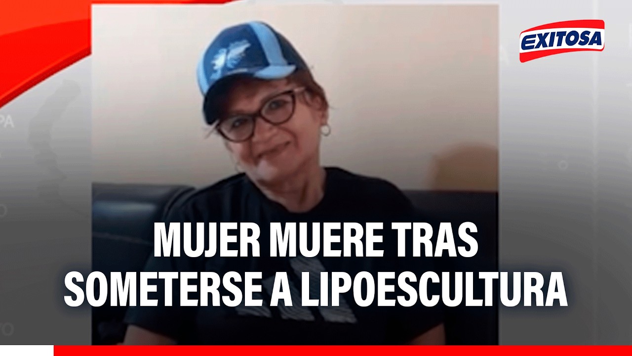 🔴🔵 La mujer de 65 años tenía antecedentes de hipertensión