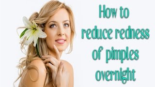 How to Reduce Redness of Pimples Overnight | Best of 2017 | Health Doctor