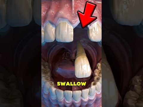 What Happens When You Swallow Your Own Tooth🤯 #shorts