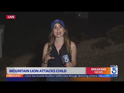 Child attacked by mountain lion in Malibu