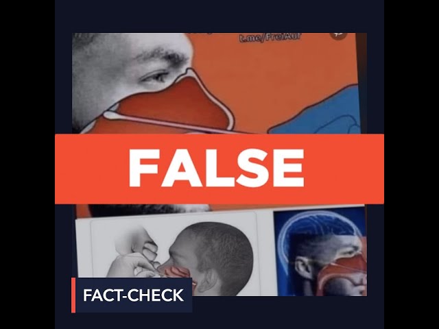 FALSE: COVID-19 nasal swabs can damage the blood-brain barrier