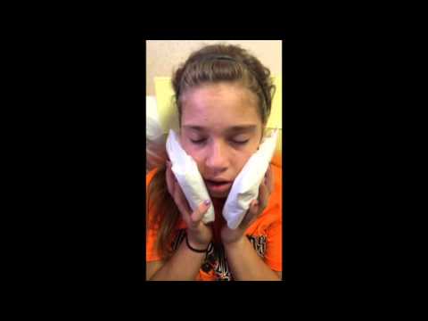 Val's Wisdom Teeth Surgery Aftermath