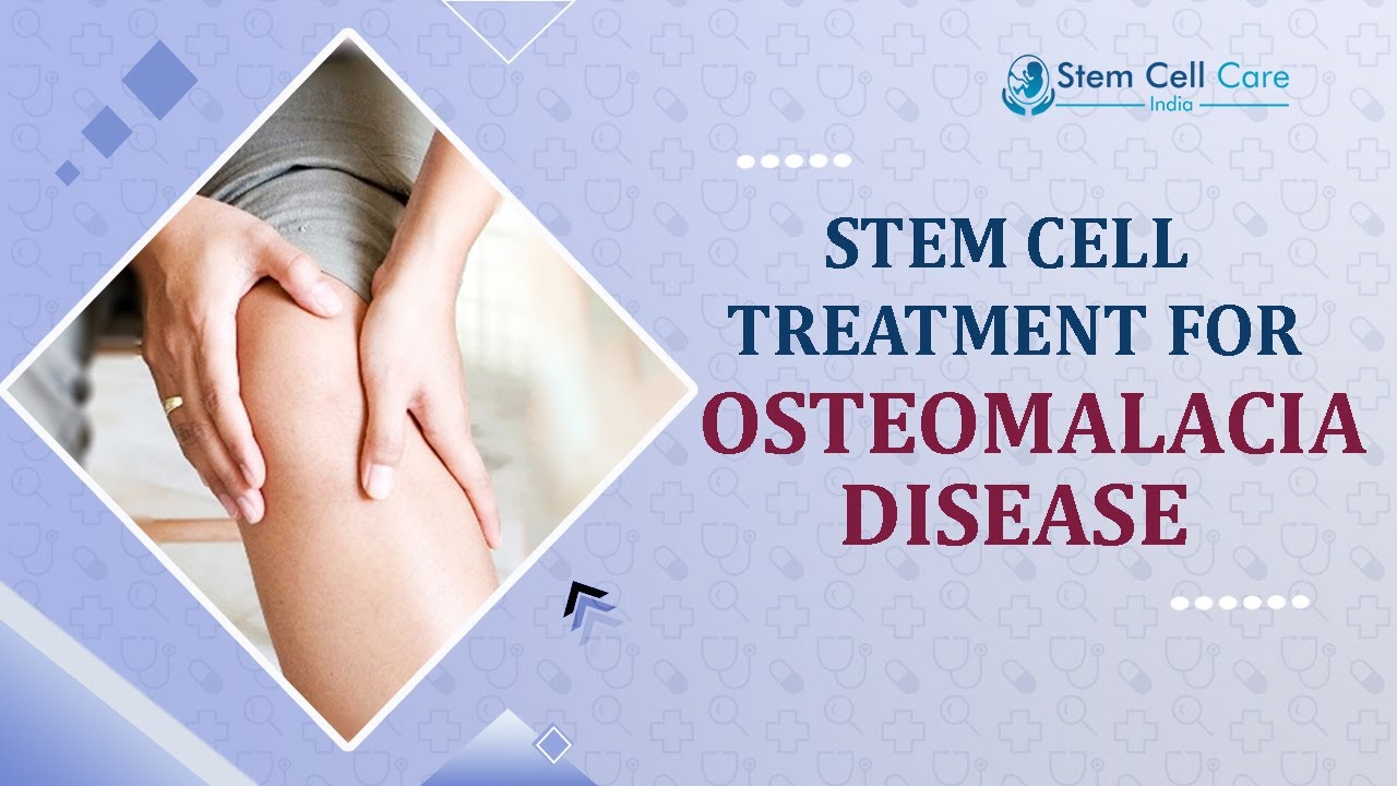 Stem Cell Transplant for Osteomalacia | Safe, and Quality Treatment | Osteomalacia | Stem Cell
