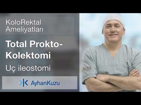 Kolorektal Ameliyatları #13 - Total Prokto Kolektomi Uç Anastamoz