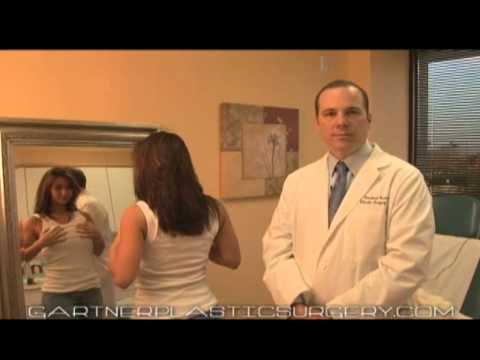 download lagu mp3 mp4 Breast Augmentation Nj, download lagu Breast Augmentation Nj gratis, unduh video klip Breast Augmentation Nj