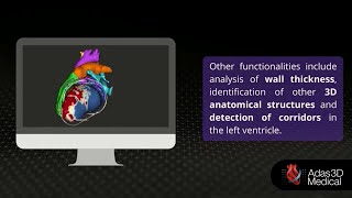 ADAS 3D Software: How does it work?