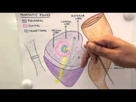 Aggressive prostate cancer life expectancy