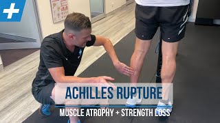 Achilles Rupture Rehab - Calf Muscle Atrophy and Strength Loss | Tim Keeley | Physio REHAB