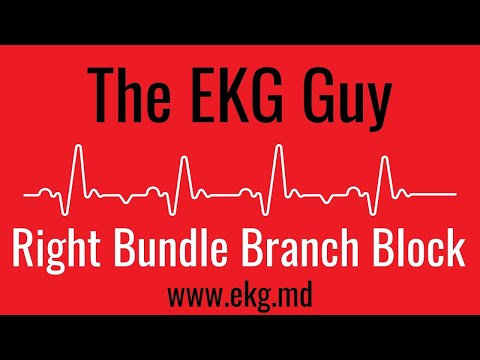 Right Bundle Branch Block (complete) on EKG / ECG l The EKG Guy - www.ekg.md