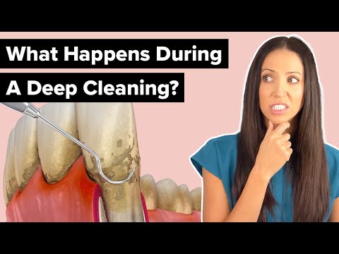 What Happens During a Deep Cleaning Procedure (Scaling and Root Planing)