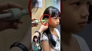 Download lagu Clogged Ear, Doctor Uses Green Paste‼️😯💥 mp3