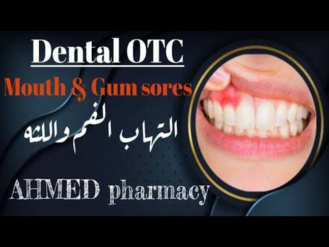 طرق علاج الأسنان وامراض اللثة