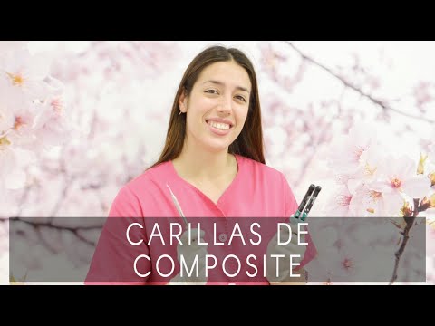 Carillas de Composite