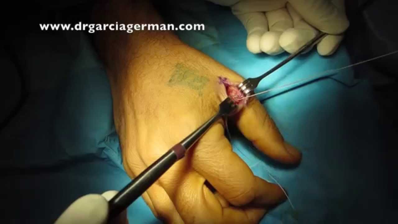 Diego García-Germán Vázquez-25