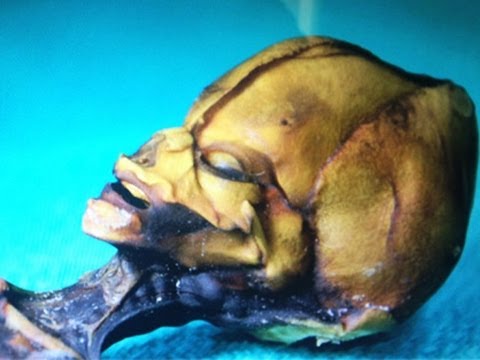 智利「迷你外星人」證屬人類 - THIS IS NOT AN ALIEN -- Mind Blow #64