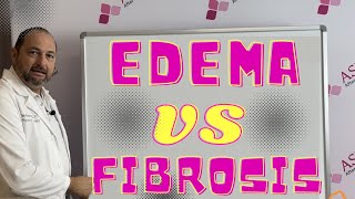 Edema VS Fibrosis- What