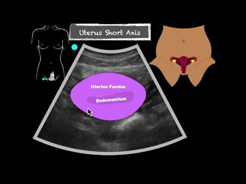 Female Pelvis Transabdominal Scanning Sequence