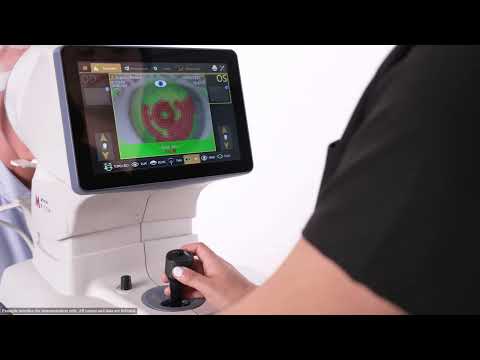 Capturing Non-Invasive Tear Break-Up Time using the Topcon MYAH