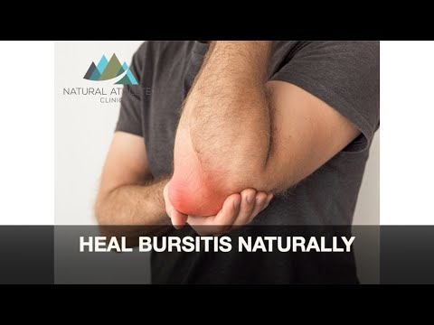 Heal Bursitis Naturally