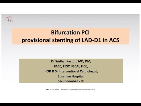Bifurcation PCI provisional stenting of LAD-D1 in ACS - Dr Sridhar Kasturi