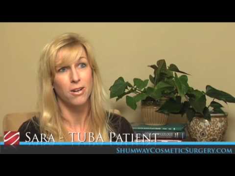 San Diego TUBA Breast Augmentation - Shumway Cosmetic Surgery in La Jolla, CA