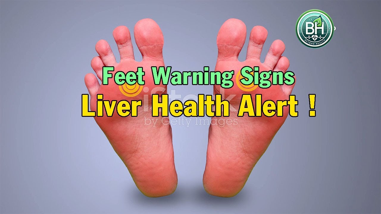 Feet Warning Signs  Liver Health Alert !