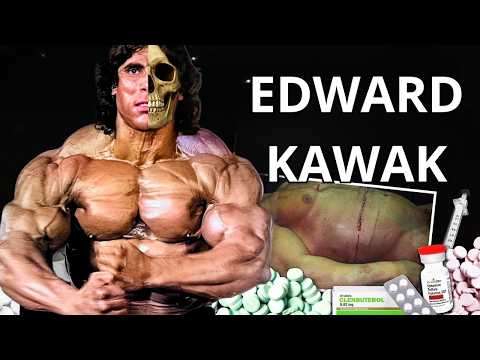 Edward Kawak: Was He a Victim of Bodybuilding?