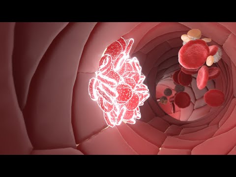 So gerinnt dein Blut  | Animation