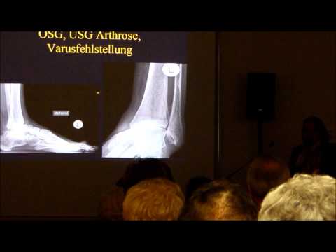 Patientenbeschwerden mit Osteochondrose der Halswirbelsäule Thorakalen Muskelkrampf