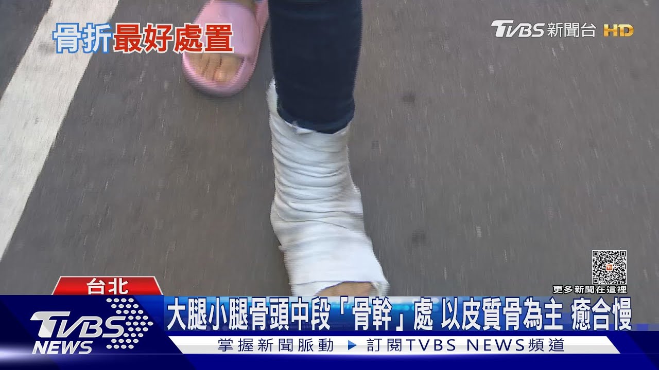 不慎發生骨折多久才會好？　醫師：「兩大指標」是關鍵勿輕忽！