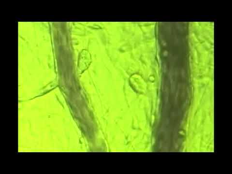 BEMER Blood Flow (2 min) with Dr  Sunny Goggin MD