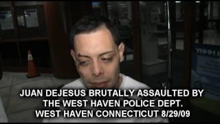 espesifiko  brutally beaten up by the west haven police department